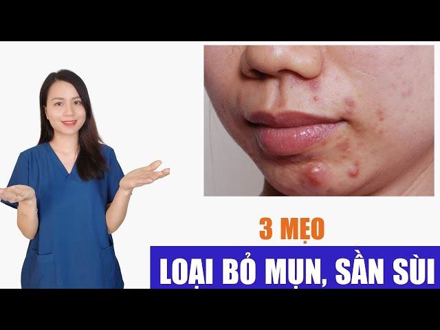 3 mẹo đơn giản giúp giảm mụn, loại bỏ da sần sùi | Nguyễn Mai Hương