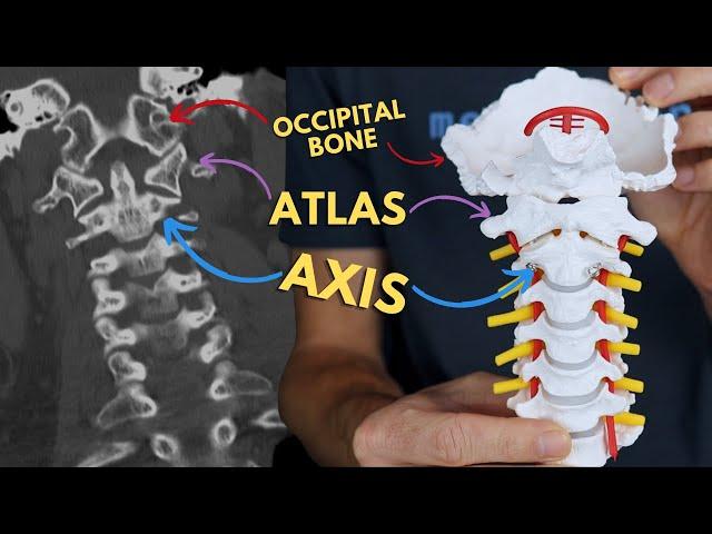 Atlantoaxial and Atlanto-occipital Joints | C1 & C2, Atlas and Axis | Radiology Anatomy Part 1 | CT