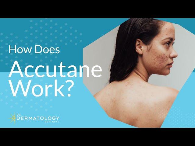 How Does Accutane Work?