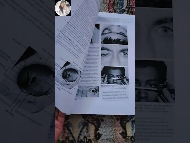 Kanski's clinical ophthalmology book #ophthalmology #optometry #optometrist #medico #missoptom