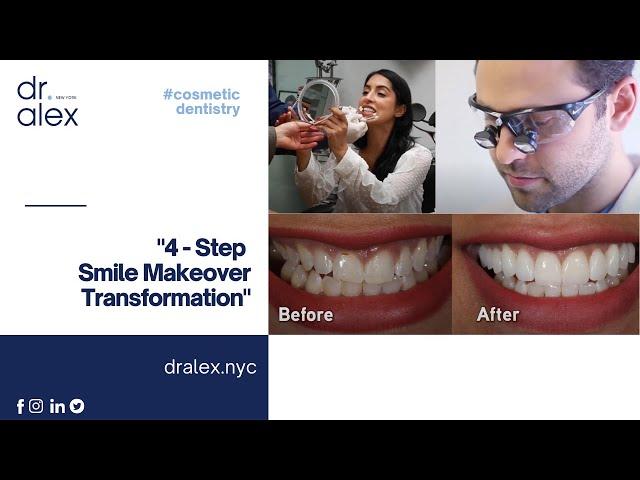 4 Steps Smile Makeover Transformation By Dr Alex Rubinov Top NYC Cosmetic Dentistry