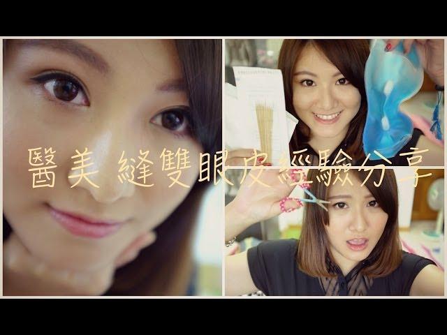  醫美整型  縫雙眼皮介紹＆術後照顧經驗分享 Plastic Surgery for Double Eyelids Experience【Chiao】