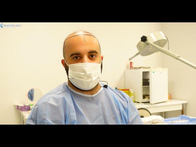 Hair Transplant in Turkey Reviews  | Dr. Bayer Clinics