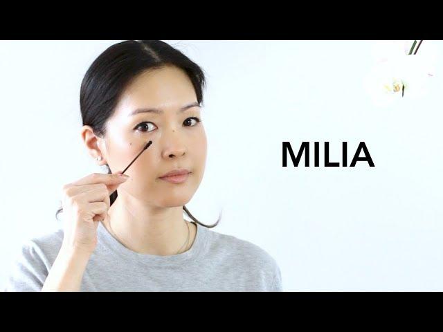 Milia - How to Treat & Prevent | Best Eye Products