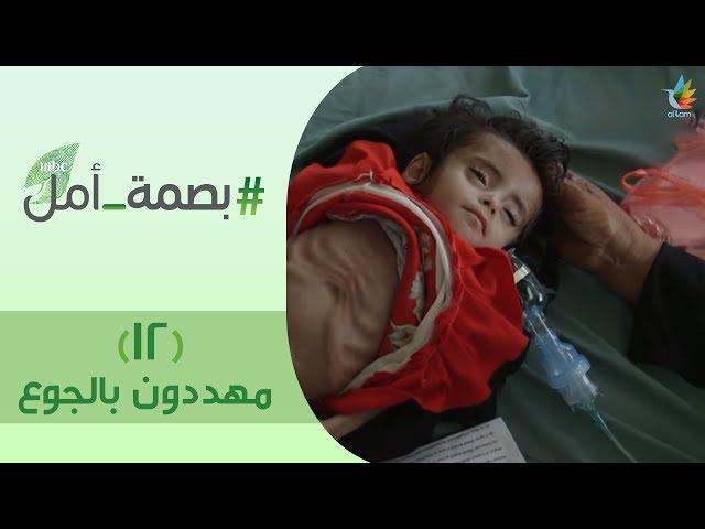 بصمة أمل 2 | #مهددون_بالجوع