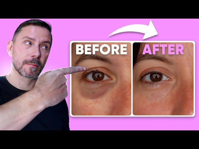 HOW TO: MAKE EYE BAGS VANISH IN SECONDS! FULL DEMO!