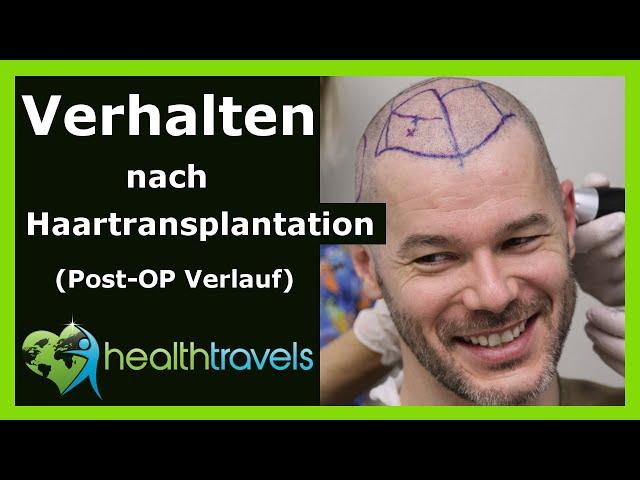 Verhalten nach Haartransplantation [Post-OP Verlauf] - Health Travels informiert