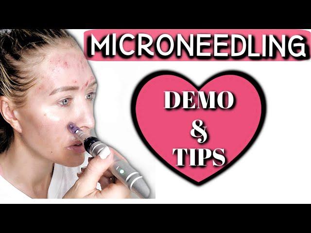 Microneedling at Home with Dr. Pen A6! | DEMO & TIPS! | How to Microneedle your Face!