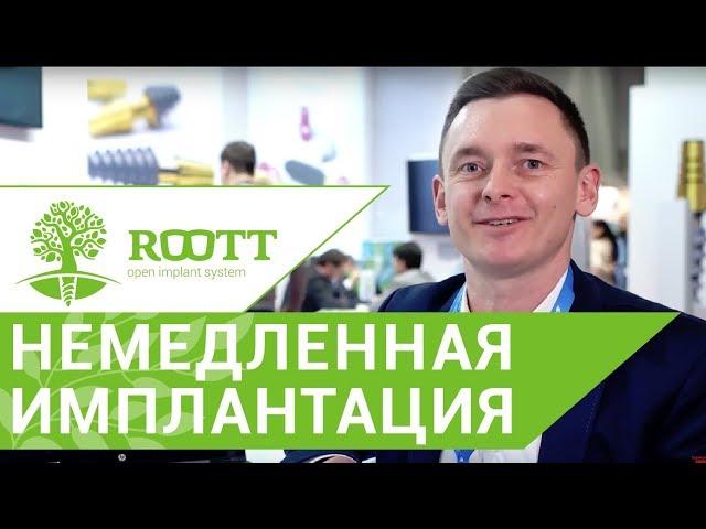 Имплантация зубов видео.  Видео о немедленной имплантации зубов в эстетически важной зоне. ROOTT