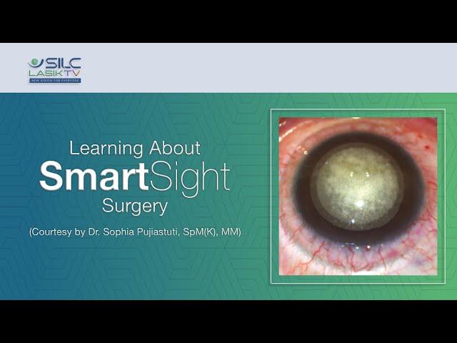 Learning About SmartSight Surgery