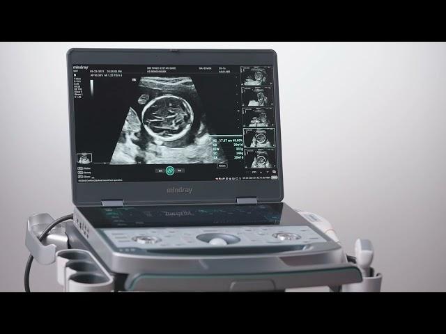 11  OBGYN Mindray MX7 Ultrasound