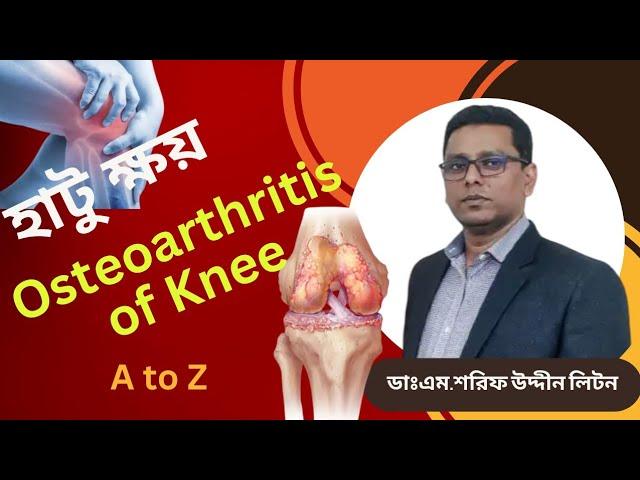 Osteoarthritis of knee||হাটু ক্ষয়||Dr.M.Sharif Uddin Liton