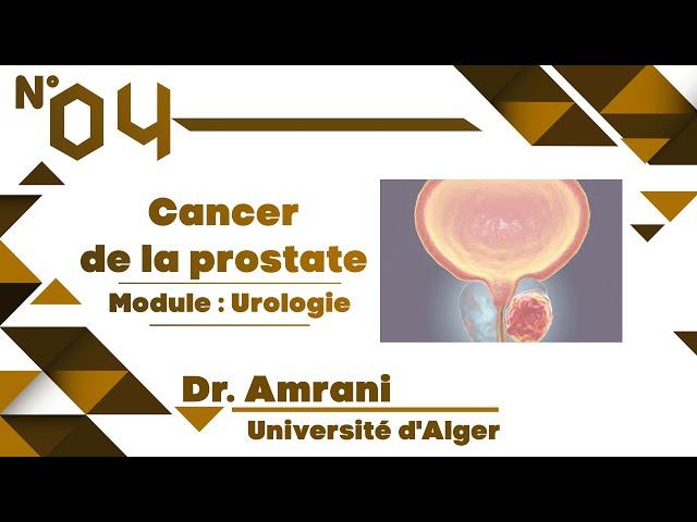 #Uro | 04. Cancer de la prostate (Dr Amrani)