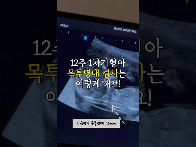 쌍둥이 1차 기형아검사(목투명대검사) #임신브이로그 #시험관 #쌍둥이임신