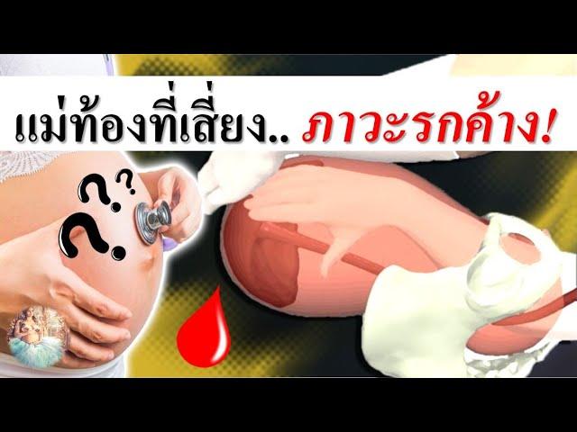 อาการคนท้อง : แม่ท้องที่เสี่ยงรกค้างหลังคลอด | รกค้าง | คนท้อง Everything