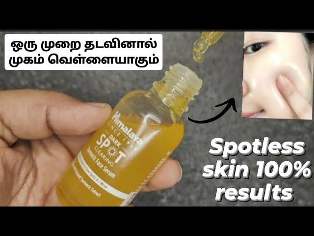 Himalaya dark spots clearing tumeric face serum review #skinwhitening #darkspots #whitening