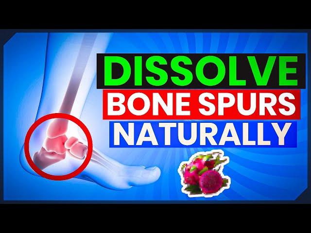 Natural Solutions: How to Dissolve Bone Spurs Without Surgery