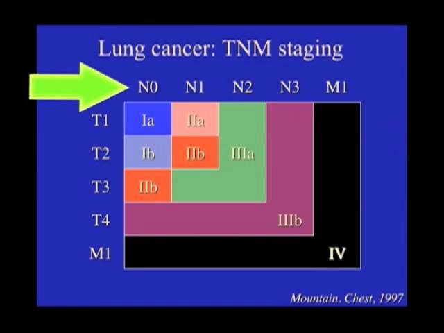 UCSF Radiology: What Does Diagnostic Imaging and Staging Tell Us?