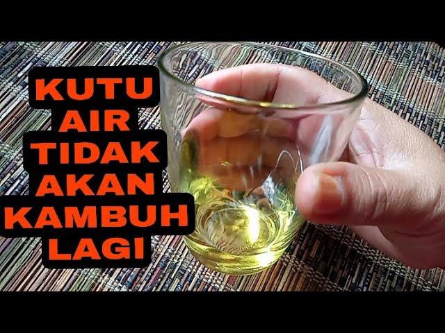 CARA MENGATASI KUTU AIR