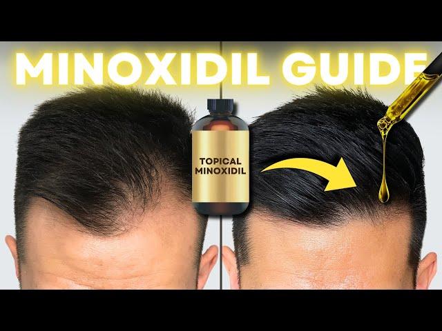 How to Regrow Hair Using Minoxidil: Step-by-Step Guide | AL GARRIDO