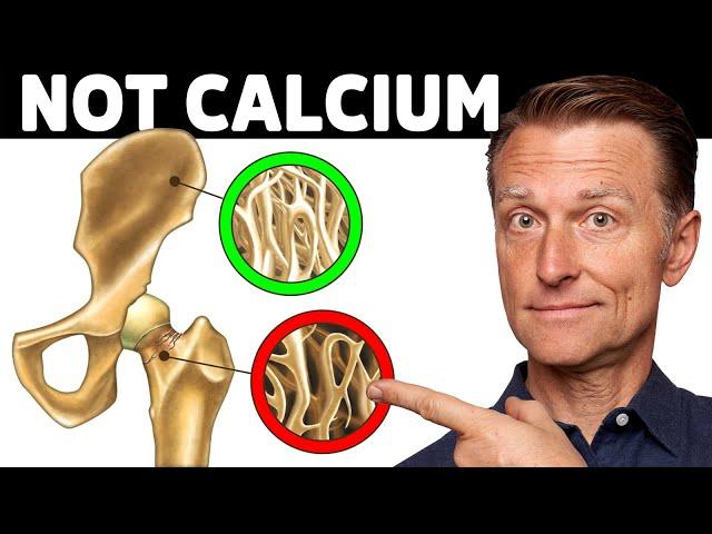 Osteoporosis Is NOT a Calcium Problem