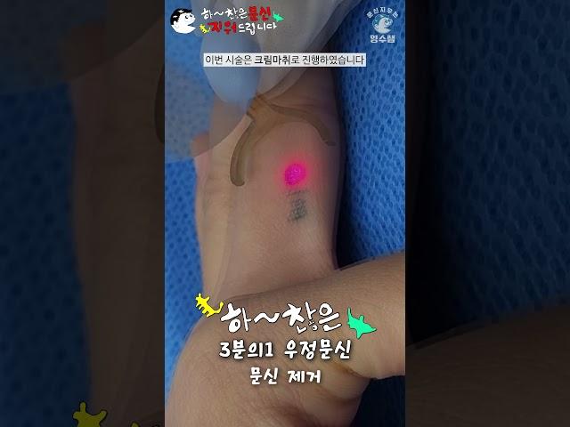 하찮은 손가락 우정문신 문신 제거 [Laser Tattoo Removal]