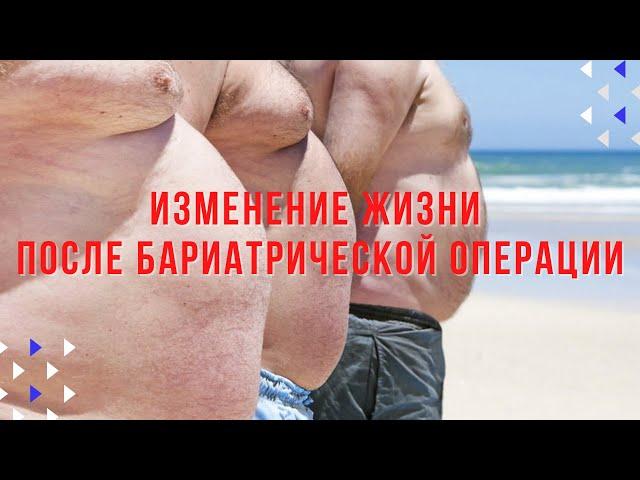 Бариатрия. Как меняется жизнь после операции по уменьшению желудка.