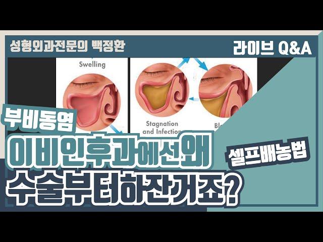 왜 부비동염 배농법은 이비인후과에서 말해주지 않는걸까요?