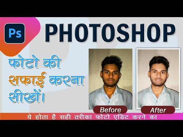 how to edit photo in photoshop | how to photo face clean  | High- End Skin Retouching in Photoshop.