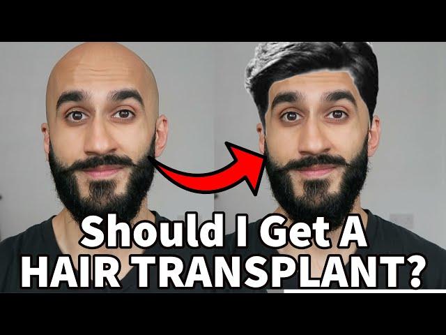 HAIR LOSS - When To Get A Hair Transplant, Hair System or SMP | Dealing With Balding