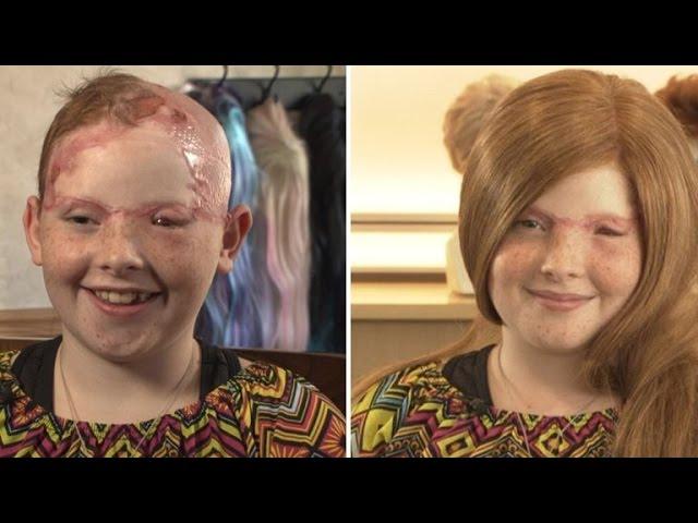11-Year-Old Girl Scalped From Carnival Ride Gets Wig For First Day of School