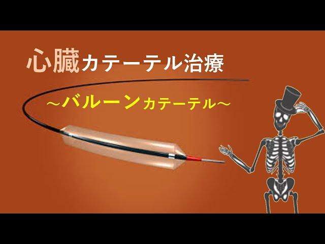 【心臓カテーテル】バルーンカテーテルの種類、用途！