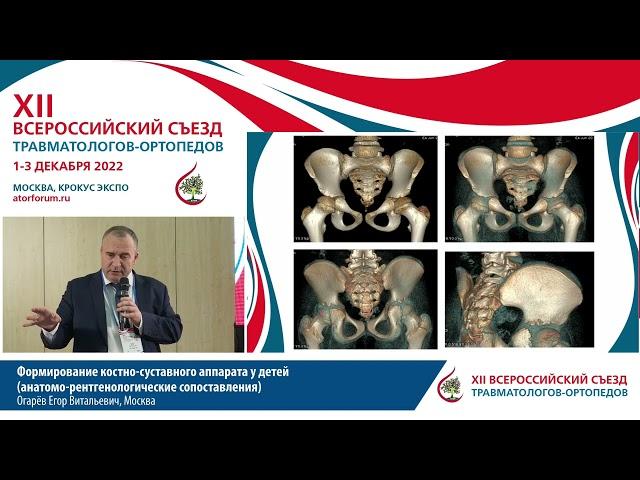 Формирование костно-суставного аппарата у детей (анатомо-рентгенологические сопоставления) Огарёв