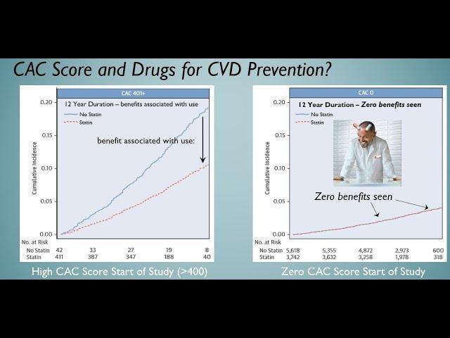 Coronary Calcification - and Fixing the Root Causes of Heart Disease #LCHF #CAC #CVD