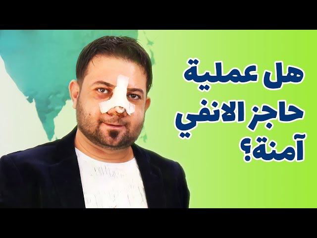 تجربة عملية تجميل الانف والجيوب والانحراف في طهران ايران لشاب من العراق