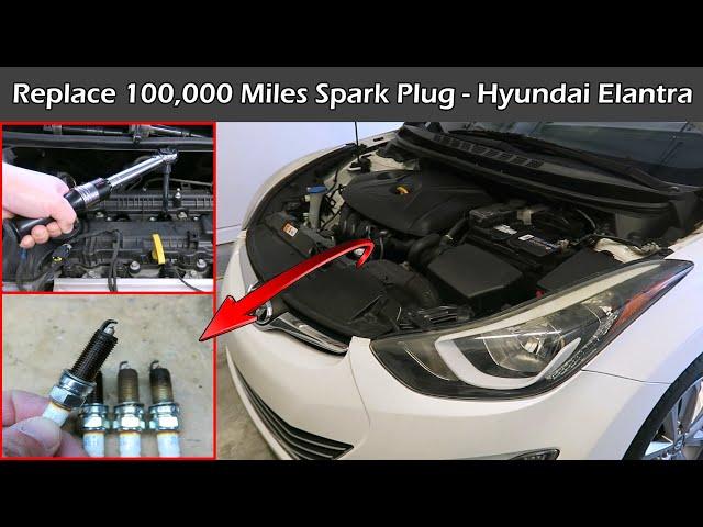 Replace 100,000 Miles Spark Plugs | NGK Iridium | Hyundai Elantra