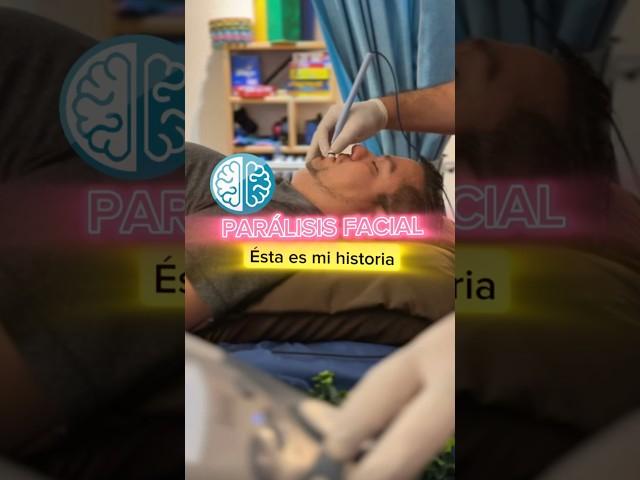 Recuperación de una Parálisis Facial #paralisisfacial #fisioterapia #fisio #cara #casodeéxito