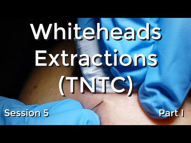 Whiteheads Extraction (TNTC) - Session 5 Part I