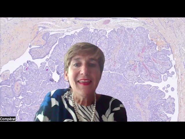 New concepts in prostate cancer pathology