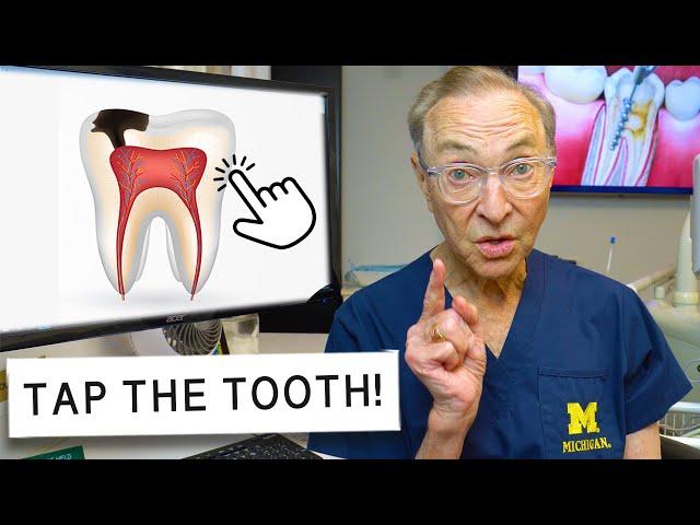 How to Tell if You Need a Root Canal (DIY Test at Home)