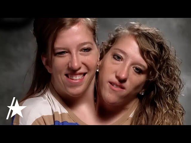 Conjoined Twin Abby Hensel Of 'Abby & Brittany' Is MARRIED