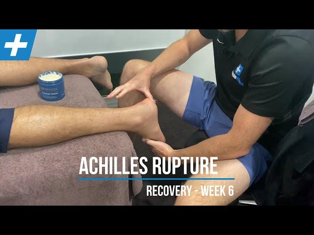 Achilles Tendon Rupture Recovery at Week 6 | Tim Keeley | Physio REHAB