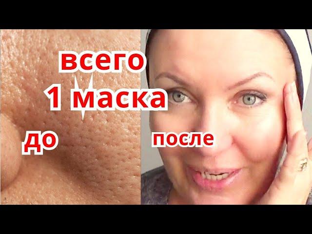 СИЛЬНЕЙШАЯ Маска для Сужения Пор !Уход за Кожей с Расширенными Порами от Морщин Рецепт