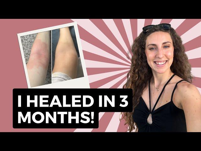 How I Healed My Eczema In 3 Months: My Journey