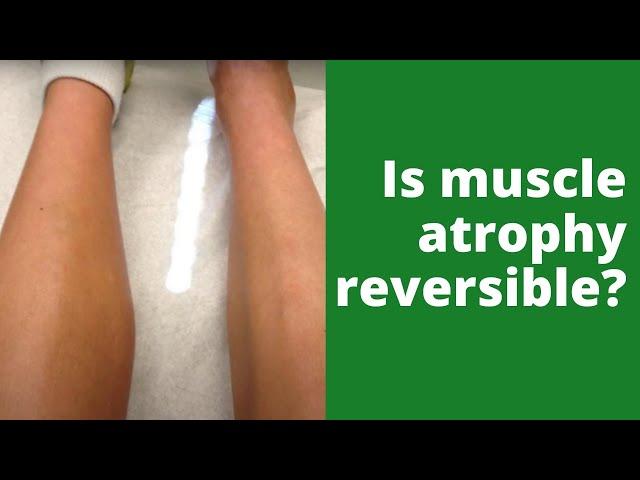 Is muscle atrophy reversible?