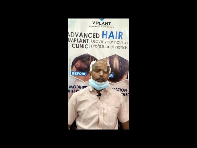 Happy Client | Testimonial | Vplant Hair Transplant Clinic