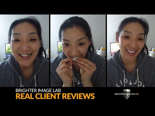 Brighter Image Lab Dental Veneer Reviews: Real Client Smile Makeovers - No Cosmetic Dentist Needed!