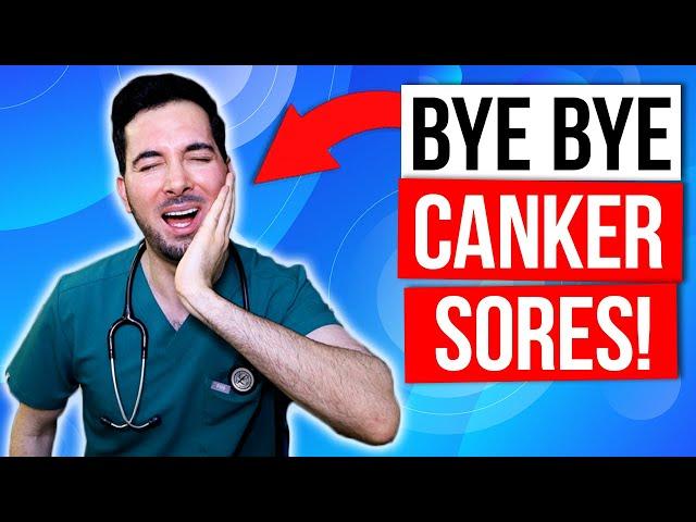 How to get rid of canker sores inside your mouth fast and treatment