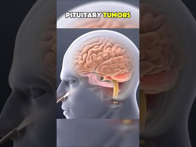 3DTHERAPY VOL-3 #healing #dentist #health #facts #selfcare #doctor #therapy #therapyvideos #tumors