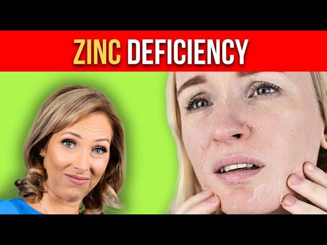 Zinc Deficiency Symptoms | Dr. Janine